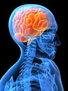adelaide-crows-sports-medicine-clinic-pain